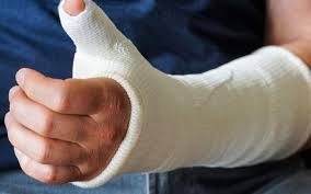 قیمت خرید باند گچی پزشکی + فروش ویژه